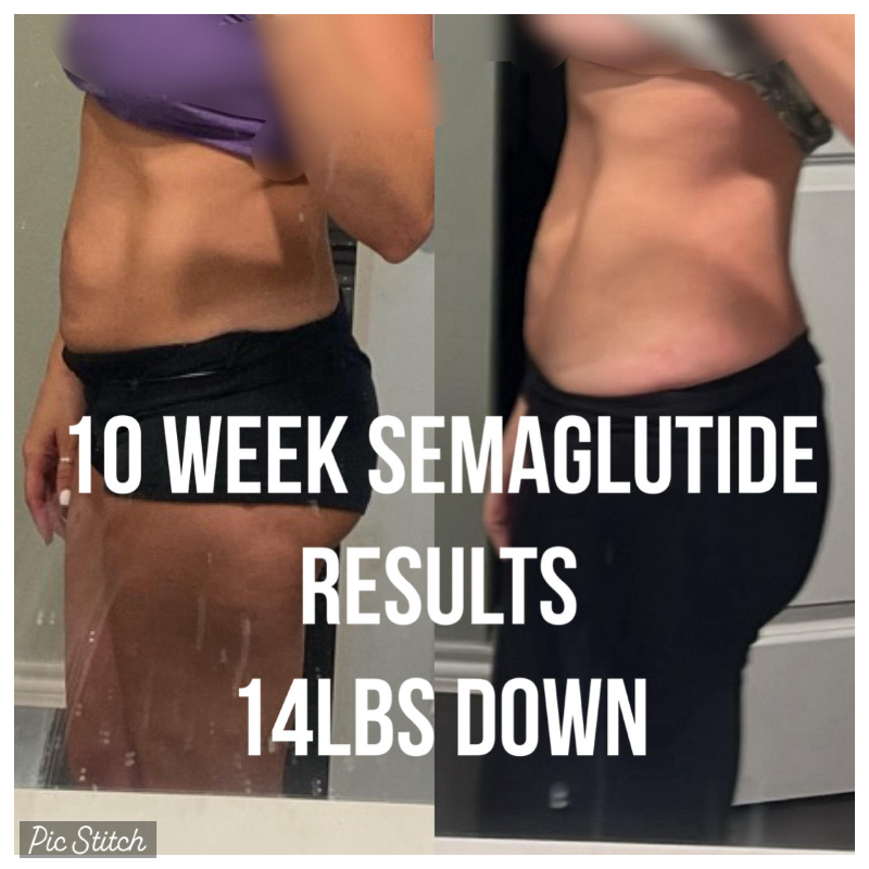 semaglutide rockwall All About Aesthetics Rockwall In Rockwall TX - Styles