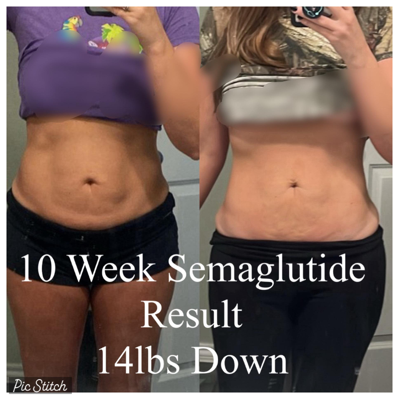 semaglutide rockwall All About Aesthetics Rockwall In Rockwall TX - Styles